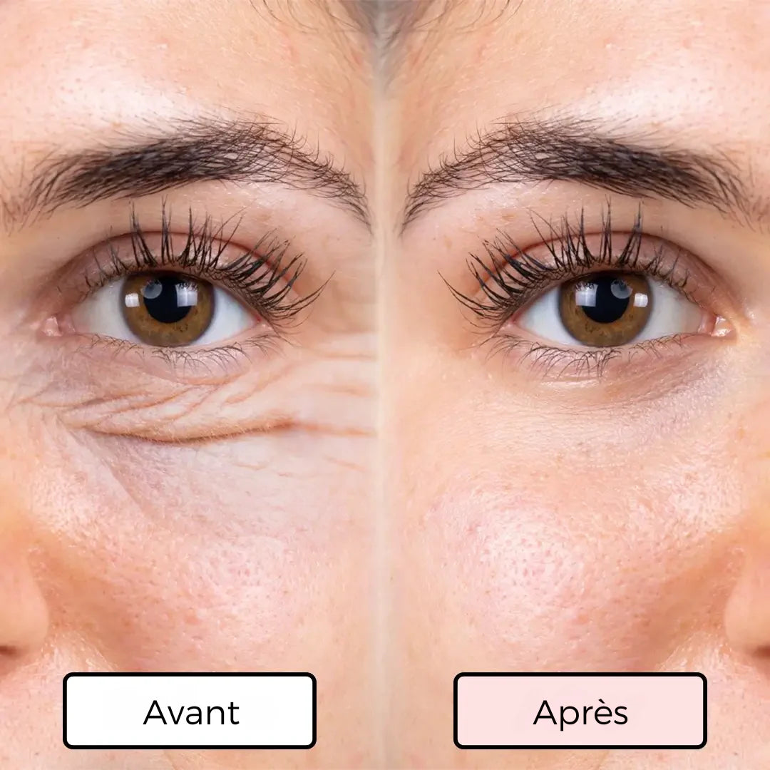 SovaLiss | Anti-poches & anti-rides + 1 SÉRUM OFFERT - Univers des Animaux
