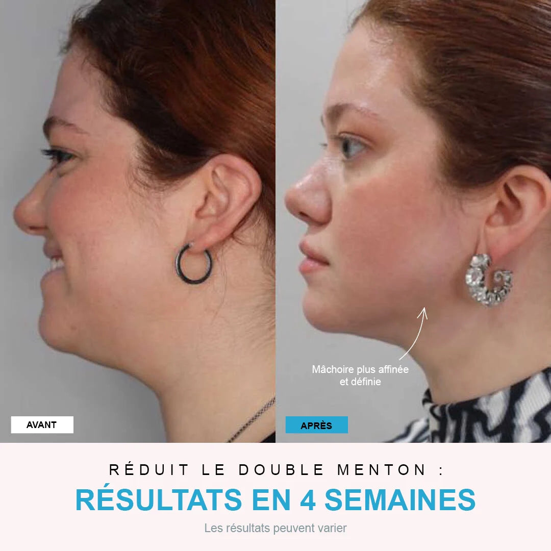 NivaLift | Appareil liftant visage + 1 SÉRUM OFFERT - Nexalias