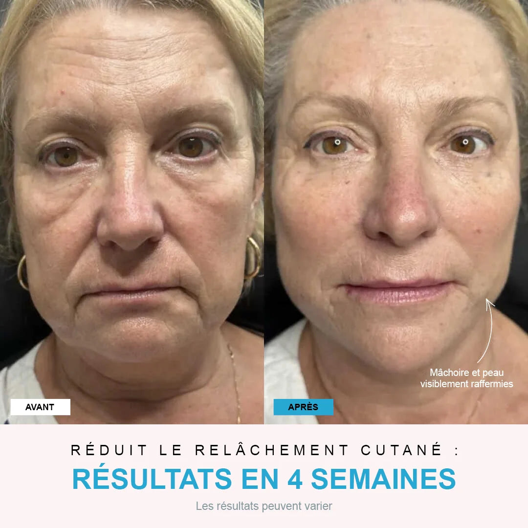 NivaLift | Appareil liftant visage + 1 SÉRUM OFFERT - Nexalias