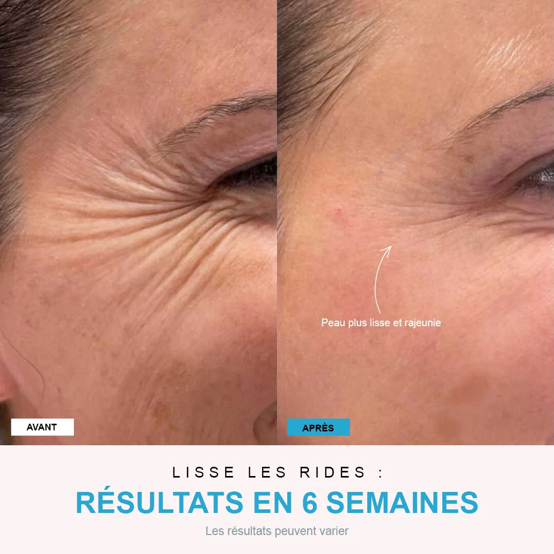 NivaLift | Appareil liftant visage + 1 SÉRUM OFFERT - Nexalias