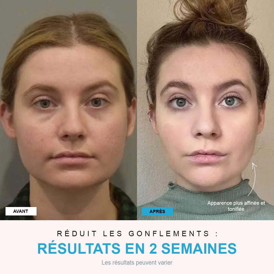 NivaLift | Appareil liftant visage + 1 SÉRUM OFFERT - Nexalias